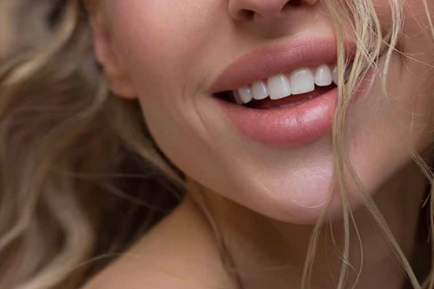 Lipfillers Nijmegen