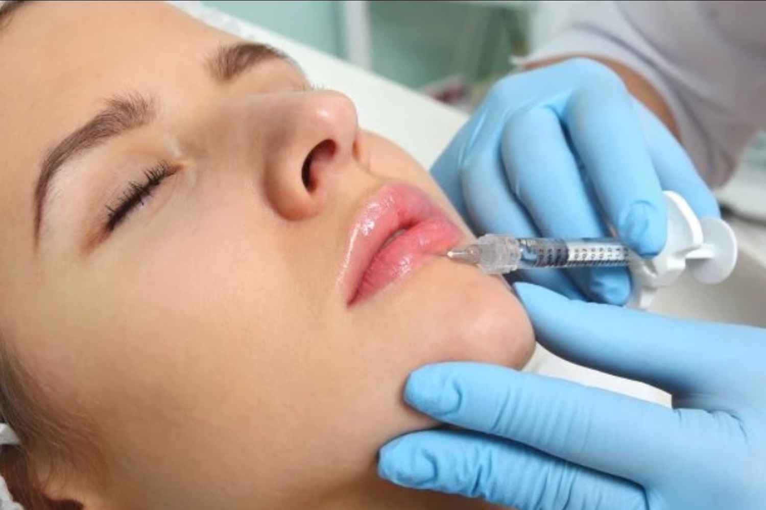 Lipfillers Amsterdam