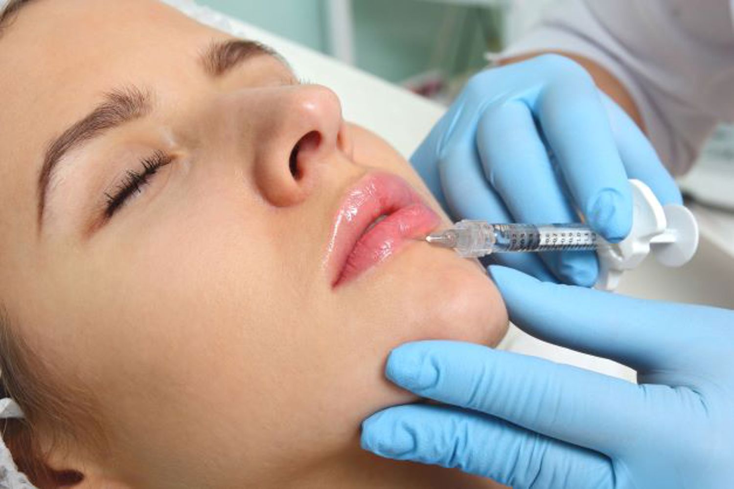 Lippen Voller Maken Met Lip Fillers In Rosmalen